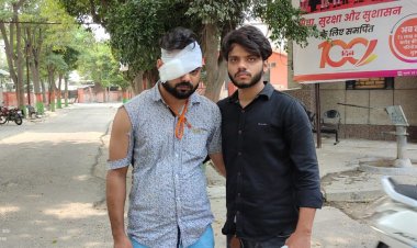 मामूली बात पर चिकित्सक की दबंगों ने सरेआम की पिटाई इस दौरान चिकित्सक की आंख में आई गंभीर चोट