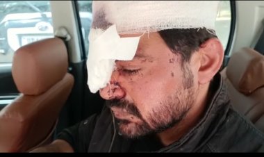 जिम संचालक की लोहे की रॉड से पिटाई कर रॉटविलर कुत्ते से कटवाया, पुलिस जांच में जुटी