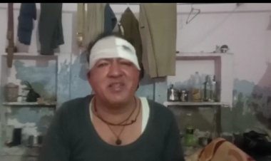 चेकिंग के दौरान फिल्मी अंदाज में डंडा मारकर हैंड कांस्टेबल को किया घायल पुलिस ने एक धरा बाकी की तलाश जारी