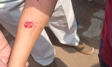 तेजस न्यूज : इस बार साहिबाबाद इलाके में पिटबुल ने बच्चे पर बोला हमला,पिटबुल के मालिक को पुलिस ने लिया हिरासत में