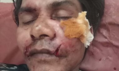 दिव्यांग जन पर छोडा पिटबुल कुत्ता