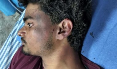 सुन्हैड़ा में आसमानी बिजली गिरने से छात्र झुलसा