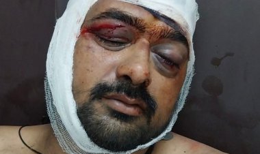 विवाद के चलते दो भाईयो को जानलेवा हमला कर किया घायल