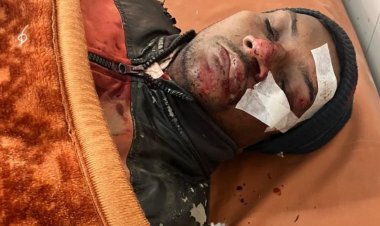 बंदरों के झुंड से बचने में बाइक सवार गहरी खाई में गिरा, हालत गंभीर