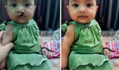 आरबीएसके की पहल से नन्ही आशी के चेहरे पर लौटी मुस्कान, परिवार ने जताया आभार