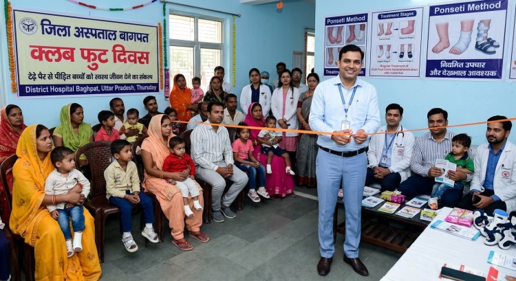 जिला अस्पताल बागपत में आयोजित हुआ क्लब फुट दिवस