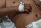 प्रताप विहार में दो पक्षों में विवाद के बाद चली गोली, युवक घायल