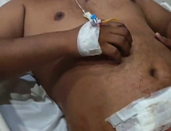 प्रताप विहार में दो पक्षों में विवाद के बाद चली गोली, युवक घायल