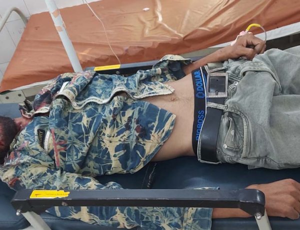 ईस्टर्न पेरीफेरल एक्सप्रेसवे पर हादसे में युवक गंभीर घायल