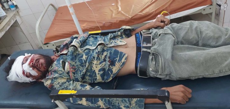 ईस्टर्न पेरीफेरल एक्सप्रेसवे पर हादसे में युवक गंभीर घायल